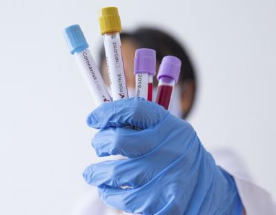 На Львівщині зафіксовано 111 нових випадків захворювання на коронавірус