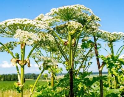 Опіки від борщівника: що варто знати в рекомендаціях медиків