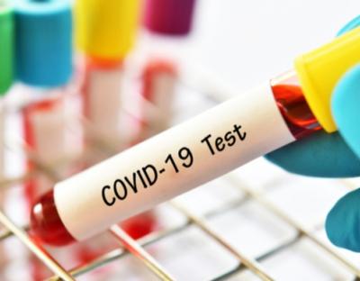 На Львівщині зафіксували 25 нових випадків захворювання на коронавірус. Госпіталізували – 9 осіб