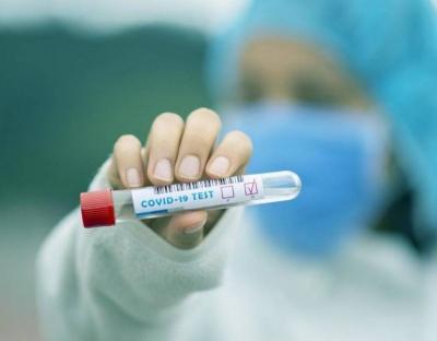 Коронавірус за добу підтвердили у 561 мешканця області