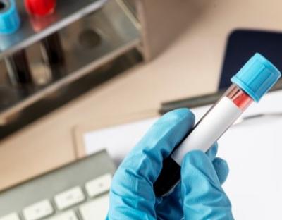 У стаціонарах області лікують 1193 пацієнтів із Covid-19