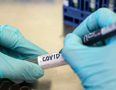 COVID-19: в області госпіталізували 271 особу