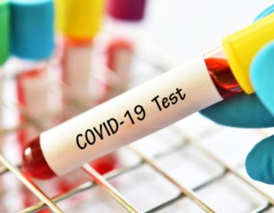 На Львівщині зафіксовано 16 нових випадків захворювання на коронавірус