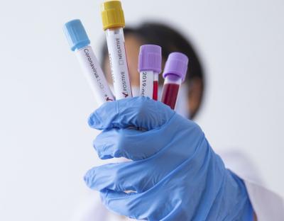 На Львівщині зафіксовано 136 нових випадків захворювання на коронавірус