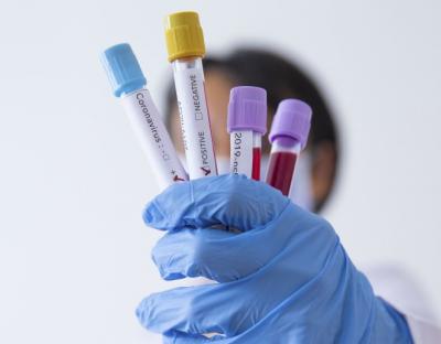 На Львівщині зафіксували 48 нових випадків захворювання на коронавірус