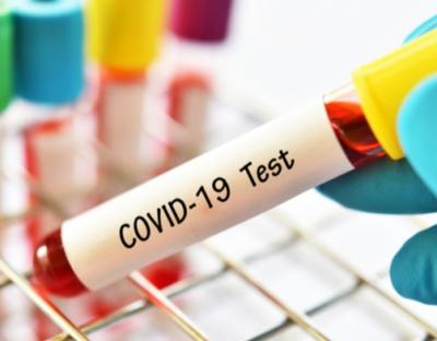 На Львівщині зафіксовано 45 нових випадків захворювання на коронавірус