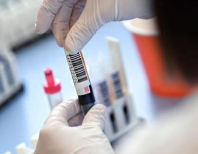 Коронавірус за добу підтвердили у 514 мешканців області