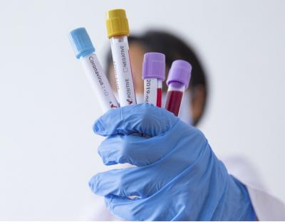 На Львівщині зафіксували 19 нових випадків захворювання на коронавірус