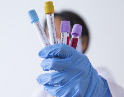 На Львівщині зафіксували 8 нових випадків захворювання на коронавірус