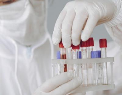 Коронавірус за добу підтвердили у 351 мешканця області, у Львові 194