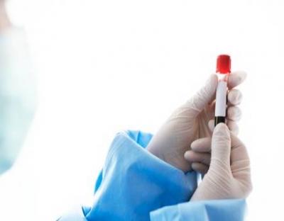 Коронавірус за добу підтвердили у 561 мешканця області, у Львові 271