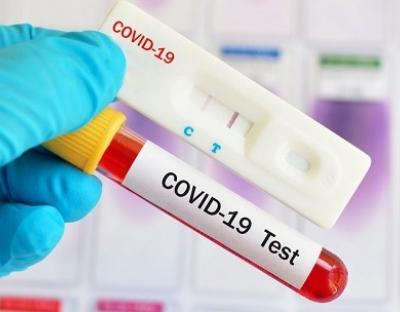 На Львівщині зафіксовано 477 нових випадків захворювання на коронавірус