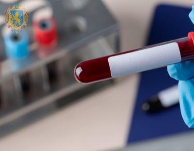 Коронавірус за добу підтвердили у 675 мешканців області, у Львові 375