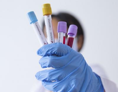 На Львівщині зафіксовано 118 нових випадків захворювання на коронавірус