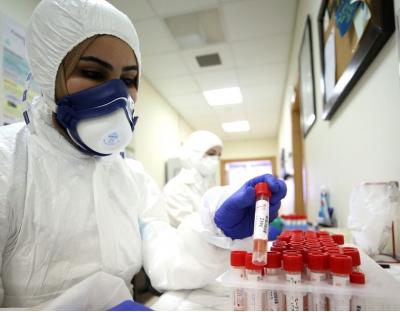 На Львівщині зафіксовано 256 нових випадків захворювання на коронавірус