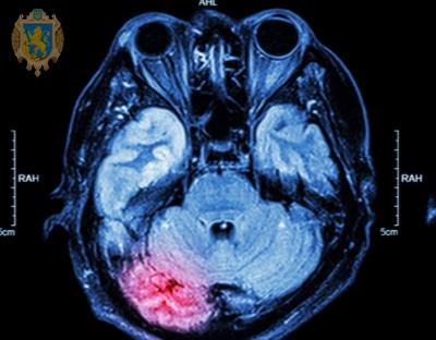 29 жовтня - Всесвітній день боротьби з інсультом