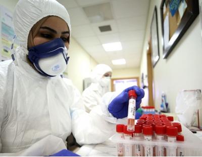 На Львівщині зафіксовано 50 нових випадків захворювання на коронавірус