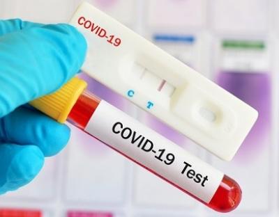 На Львівщині зафіксовано 492 нових випадки захворювання на коронавірус