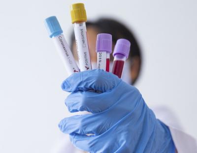 На Львівщині зафіксували 30 нових випадків захворювання на коронавірус