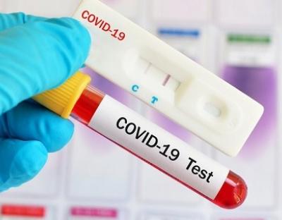 На Львівщині зафіксовано 1085 нових випадків захворювання на коронавірус