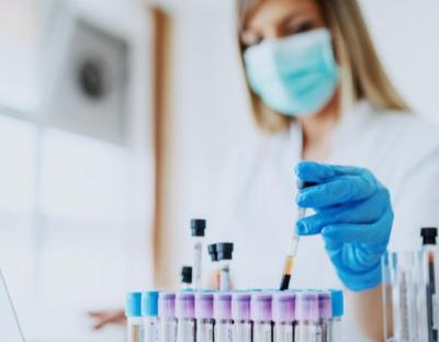 COVID-19: за добу майже 400 нових хворих і  2 летальних випадки