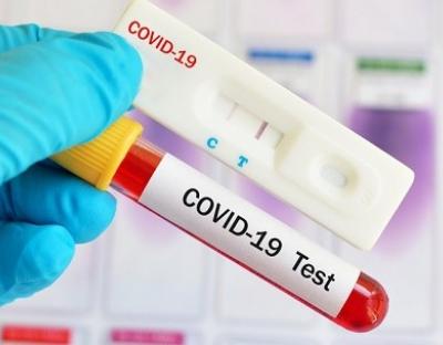 На Львівщині зафіксовано 963 нових випадки захворювання на коронавірус