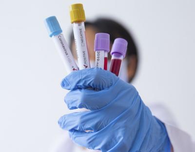 На Львівщині зафіксували 29 нових випадків захворювання на коронавірус