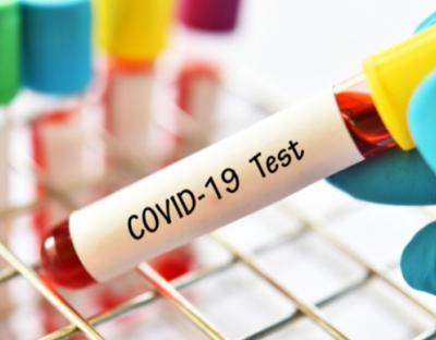 На Львівщині зафіксували 29 нових випадків захворювання на коронавірус