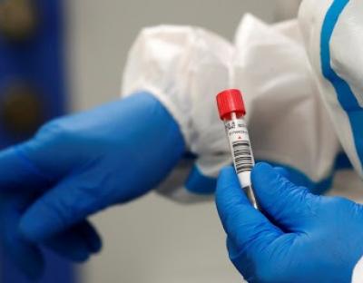 У стаціонарах області від коронавірусу лікують 2010 пацієнтів