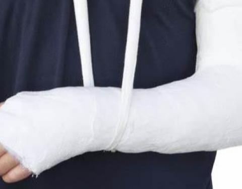 Як діяти у випадку перелому кісток: роз'яснення Центру громадського здоров’я