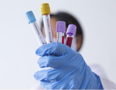 На Львівщині зафіксовано 104 нових випадки захворювання на коронавірус