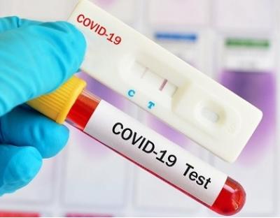 На Львівщині зафіксовано 461 новий випадок захворювання на коронавірус