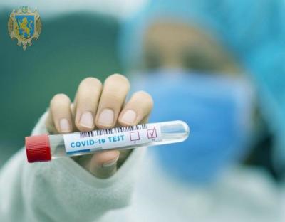 Ознаки для визначення регіону зі значним поширенням COVID-19