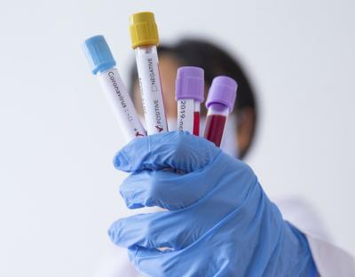 На Львівщині зафіксували 12 нових випадків захворювання на коронавірус