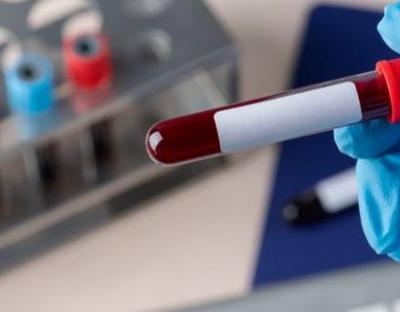 У стаціонарах області лікують 1406 пацієнтів із Covid-19