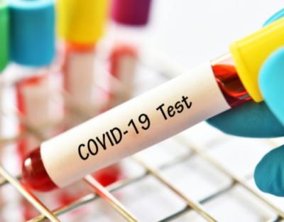 На Львівщині зафіксували 23 нових випадки захворювання на коронавірус. Госпіталізували – 21 особу