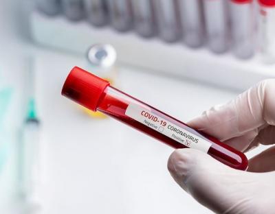 На Львівщині зафіксували понад 1100 нових випадків захворювання на коронавірус