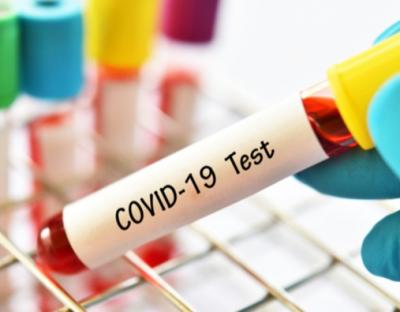 На Львівщині зафіксовано 55 нових випадків захворювання на коронавірус