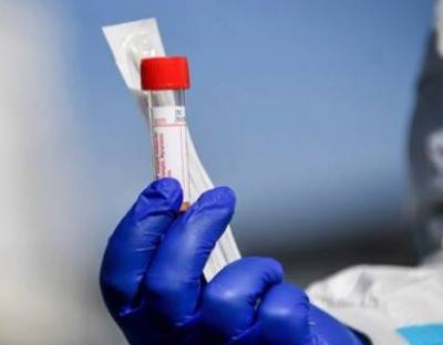 COVID-19: в області госпіталізовано 127 осіб