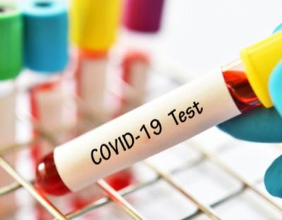 На Львівщині зафіксовано 28 нових випадків захворювання на коронавірус