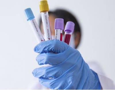 На Львівщині зафіксовано 259 нових випадків захворювання на коронавірус