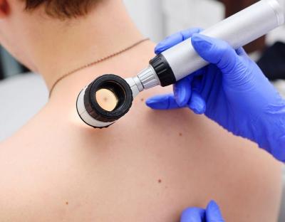 24 квітня - Всеукраїнський день боротьби з меланомою