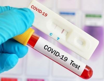 На Львівщині зафіксовано 1538 нових випадків захворювання на коронавірус