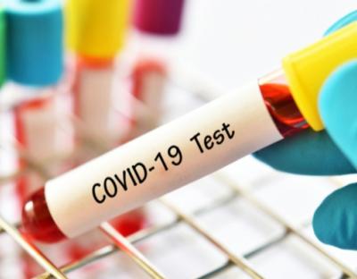 На Львівщині зафіксували 183 нових випадки захворювання на коронавірус. Госпіталізували – 58 осіб