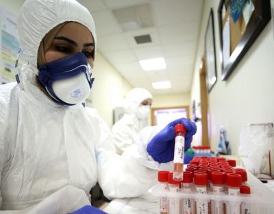 На Львівщині зафіксовано 166 нових випадків захворювання на коронавірус