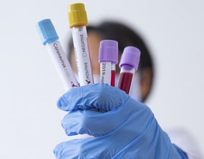 На Львівщині зафіксували 7 нових випадків захворювання на коронавірус