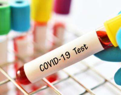 На Львівщині зафіксували 32 нових випадки захворювання на коронавірус