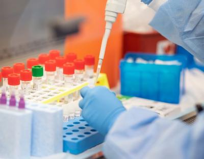 На Львівщині зафіксували 61 новий випадок захворювання на коронавірус. Госпіталізували – 13 осіб