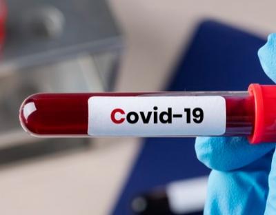 У стаціонарах області лікують 1543 пацієнтів із Covid-19