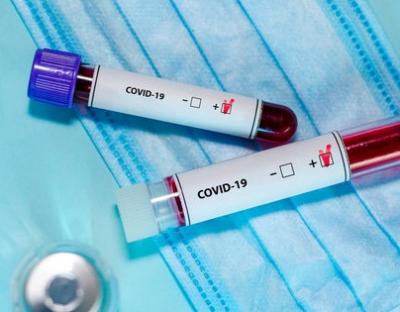 У стаціонарах області від коронавірусу лікують 2024 пацієнтів